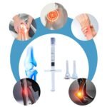 ÁCIDO HIALURÓNICO INTRARTICULAR 90MG / 3ML - BOULIGA - Imagen 3